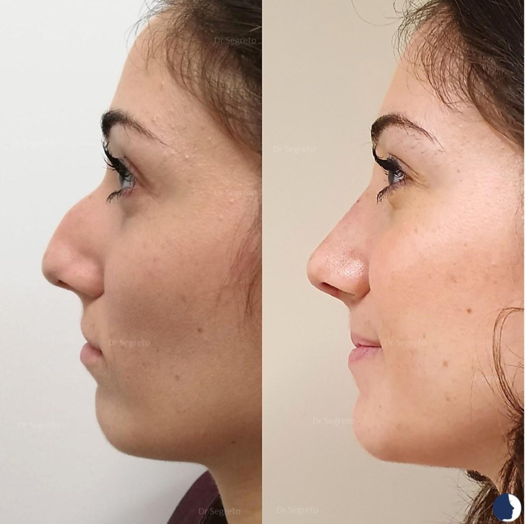 sanimed-roma_Rinoplastica sito